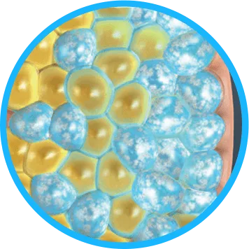 Illustration of fat cells crystallising under cooling for CoolSculpting fat freezing in Dublin