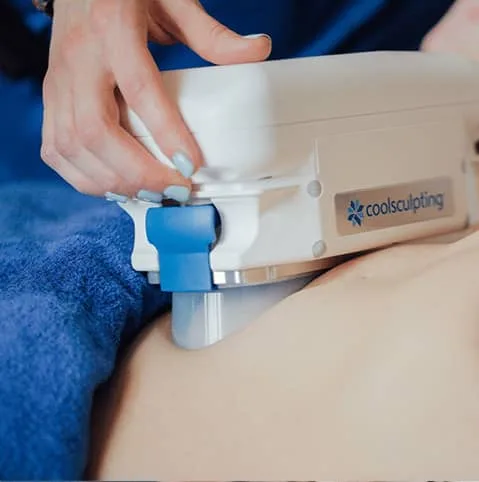 Hands fitting a fat freezing applicator to a patient's abdomen at Cool Clinic, CoolSculpting fat freezing Dublin